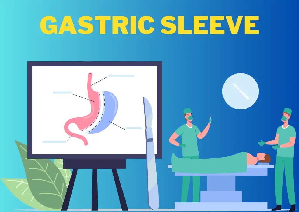 Gastric Sleeve Surgery – FAQs?